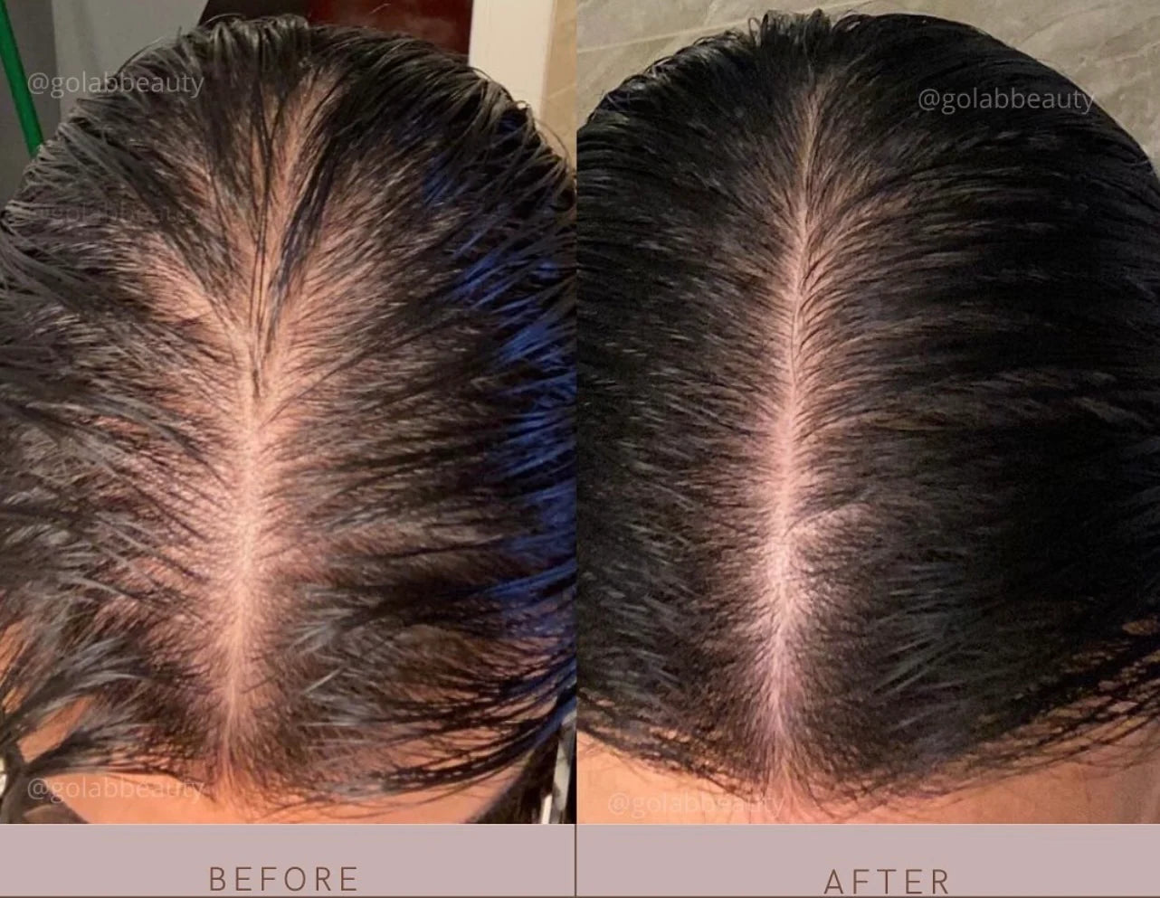 STRENGTHENING SCALP MASSAGE OIL