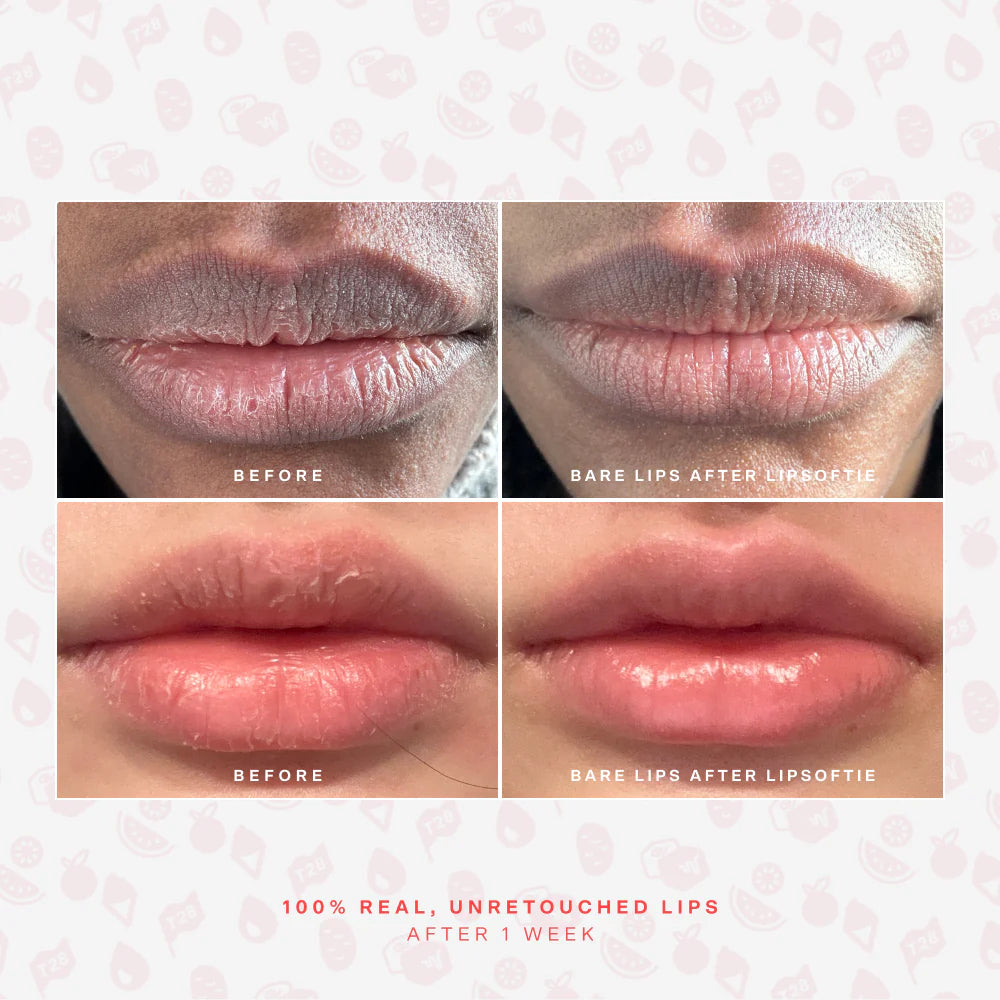 Tower28 LipSoftie Lip Treatment Set