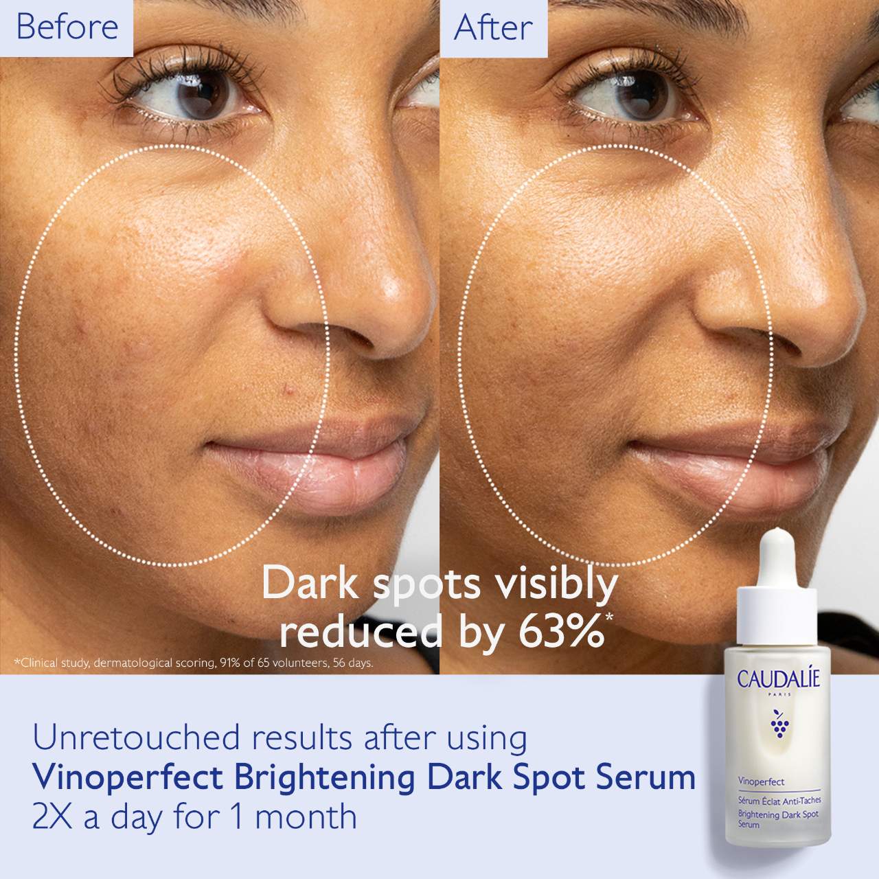 Caudalie  Vinoperfect Brightening Routine for Dark Spots and Uneven Skin Tone
