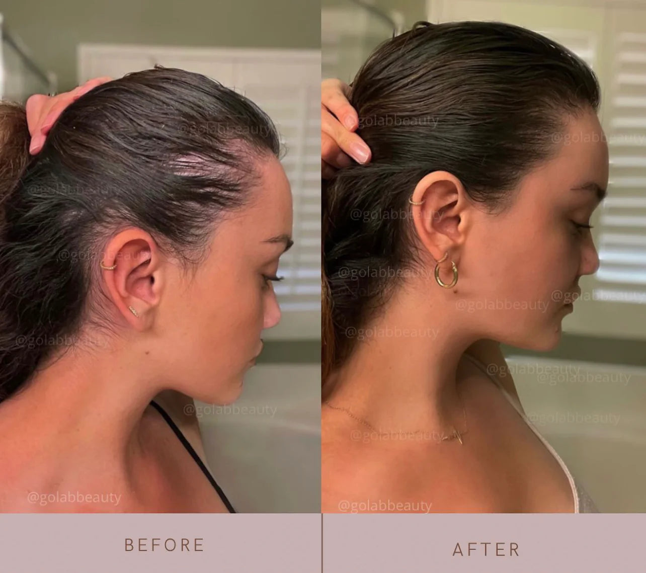 STRENGTHENING SCALP MASSAGE OIL