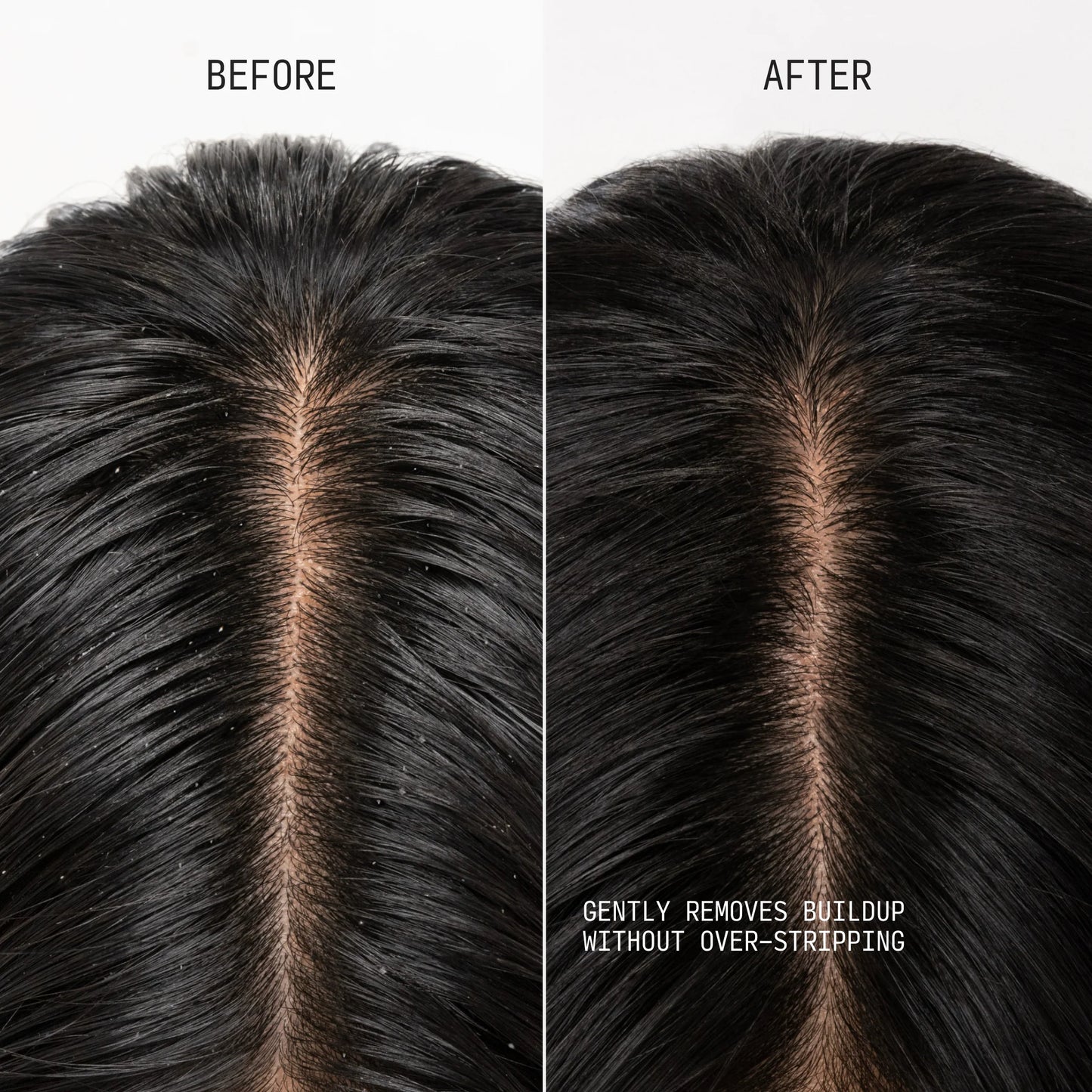 CLARIFYING SHAMPOO & SCALP SCRUB