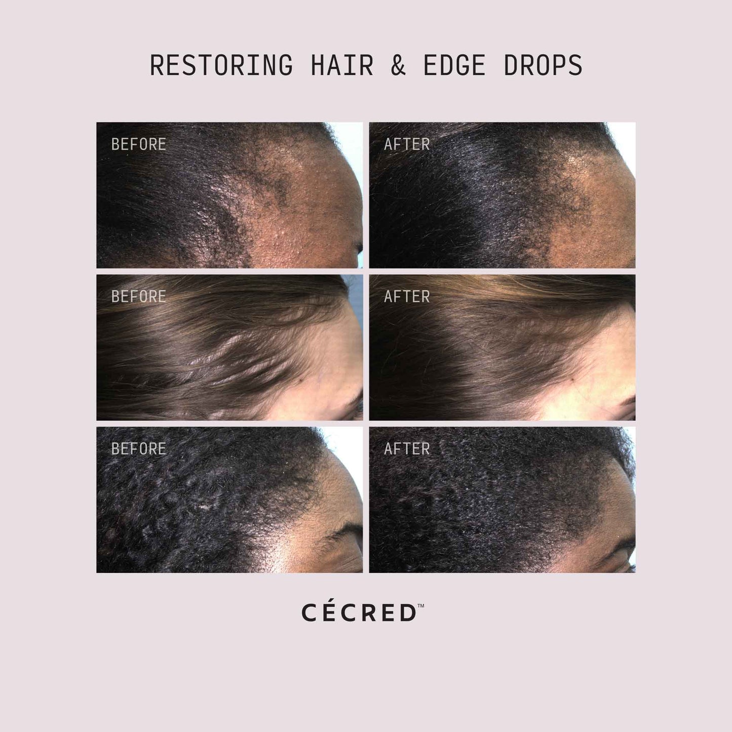 RESTORING HAIR & EDGE DROPS
