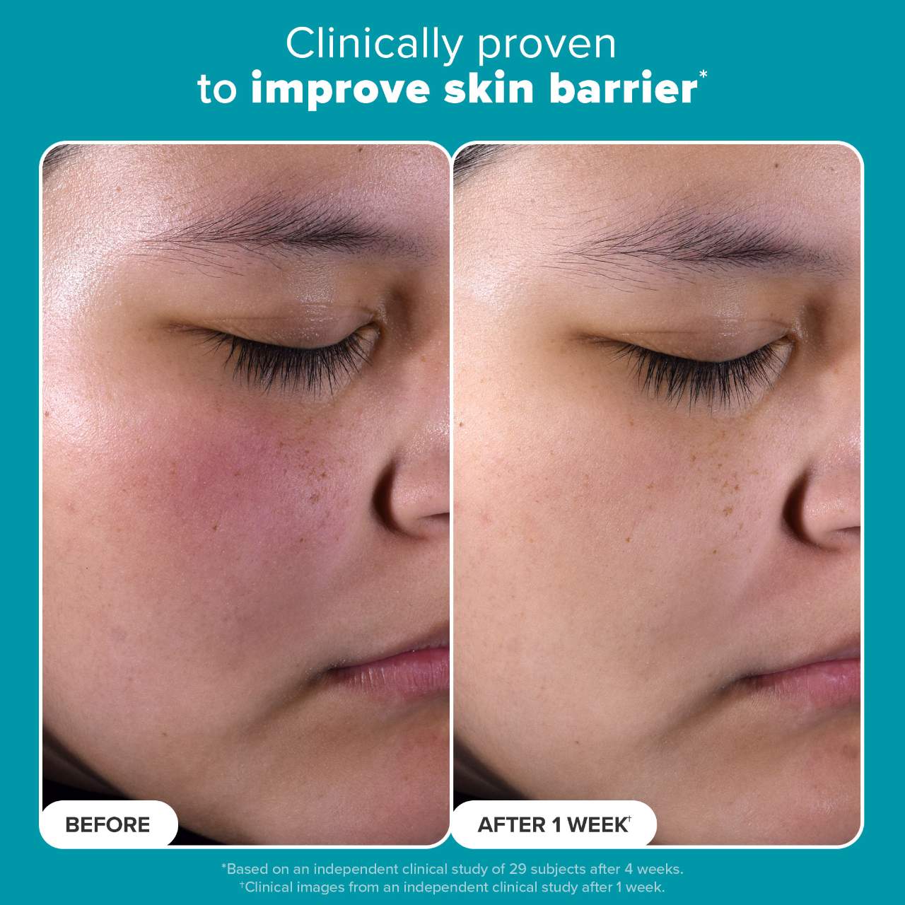 Paula's Choice  Skin Perfecting 2% BHA Liquid Exfoliating Toner for Clear Skin