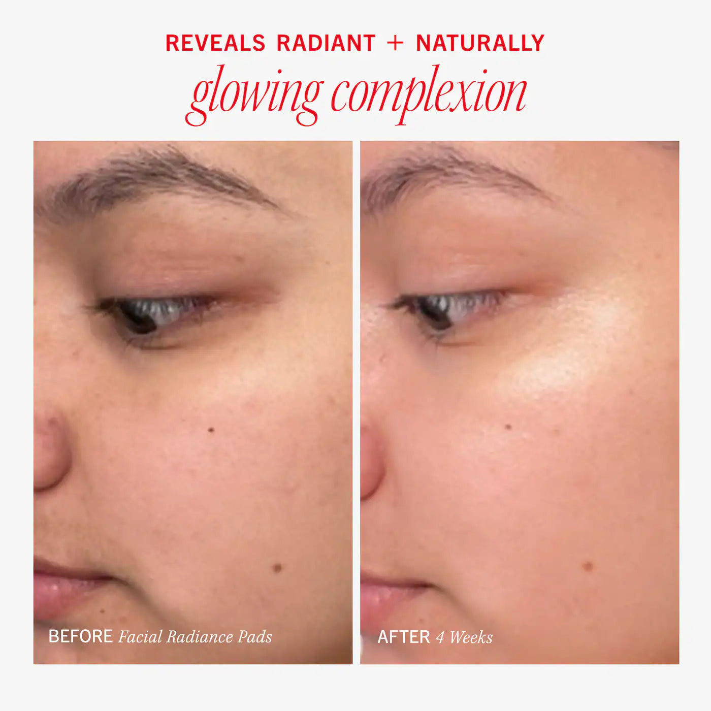First Aid Beauty  Facial Radiance Pads with Glycolic + Lactic Acids – Exfoliating Pads with AHA