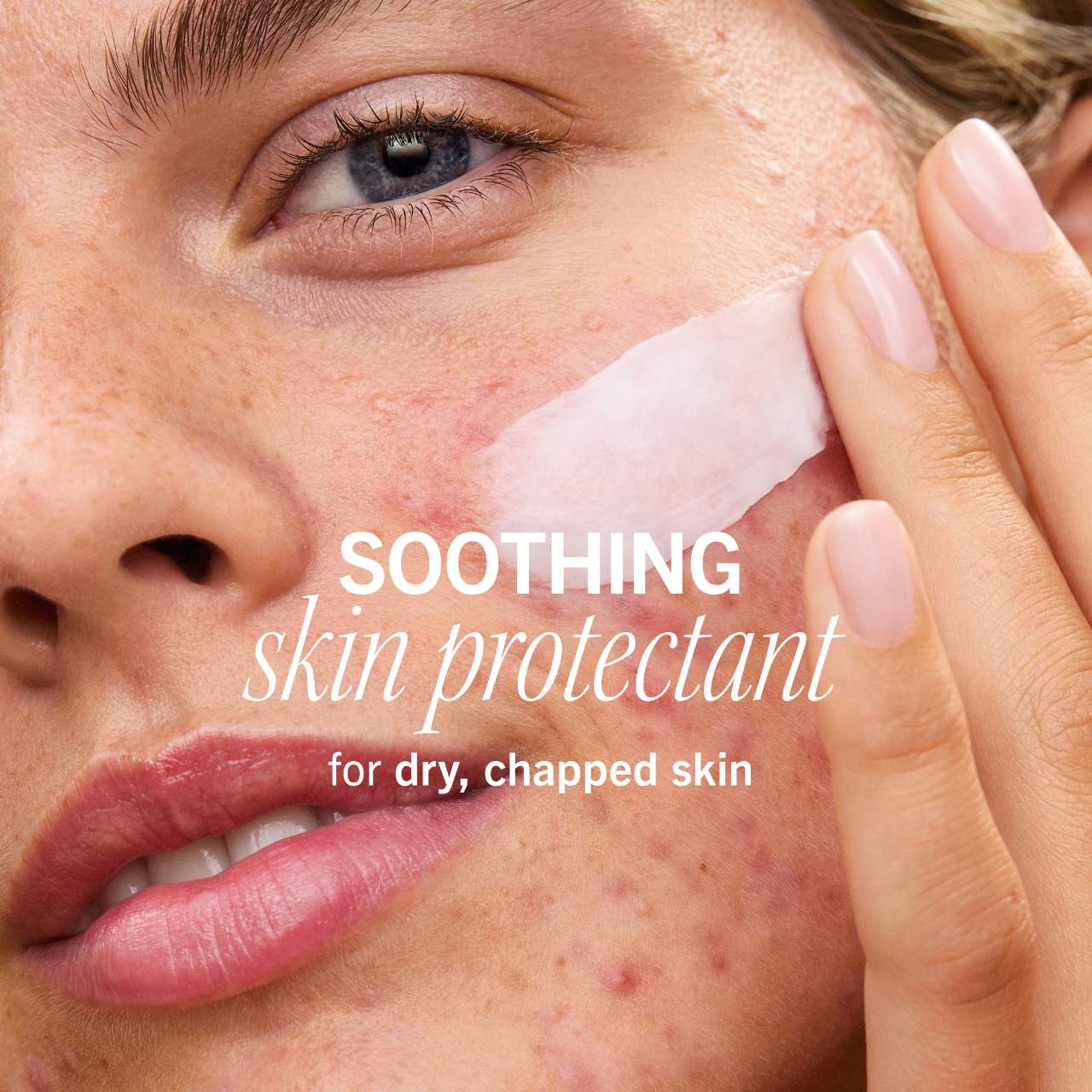 First Aid Beauty  Ultra Repair Rescue Skin Barrier Balm