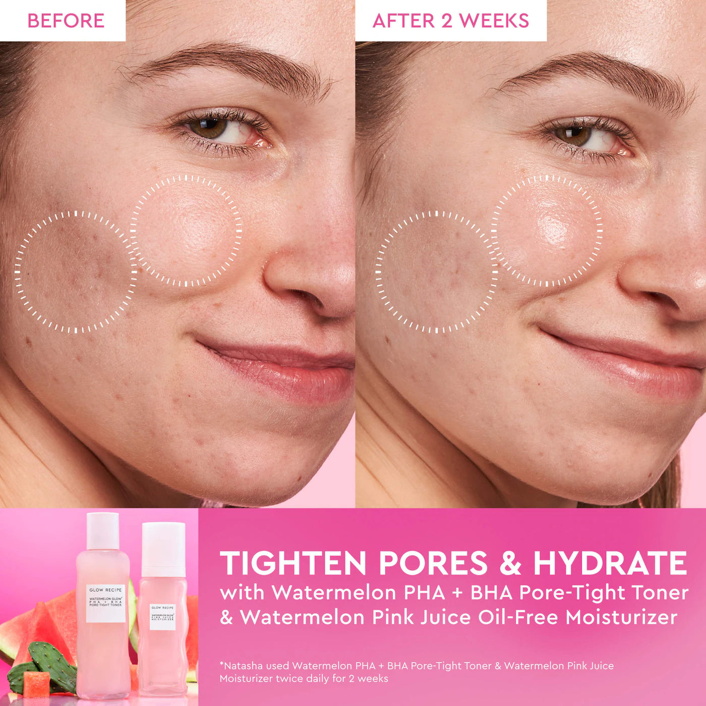 Glow Recipe  Watermelon Glow Dewy Skin Routine Gift Set